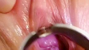 Redhead Claudia gyno pussy speculum gaping