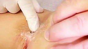 Redhead Claudia gyno pussy speculum gaping