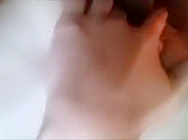 Skin CLappin